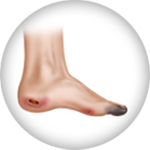 Ankle with critical limb ischemia icon