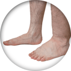 Ankle injury icon