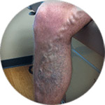 Varicose veins icon