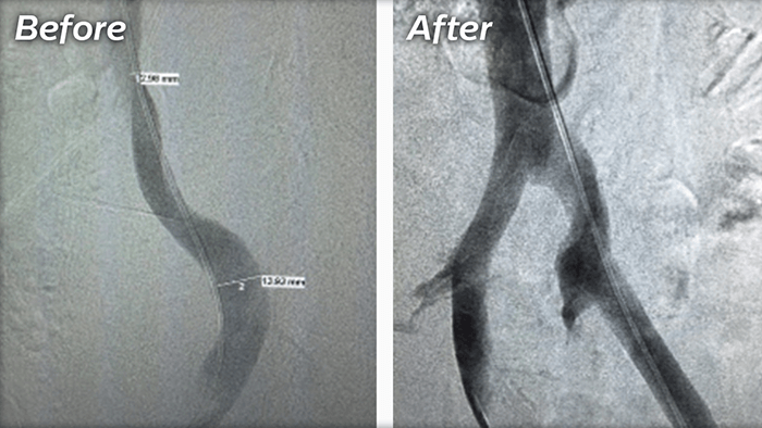 Before after scan