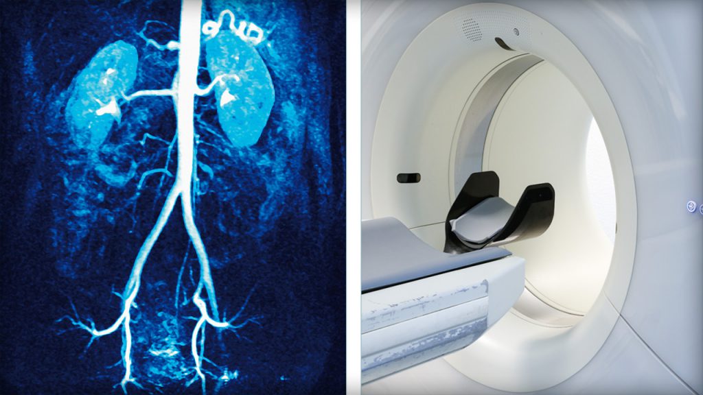 Magnetic resonance angiography scanner and product