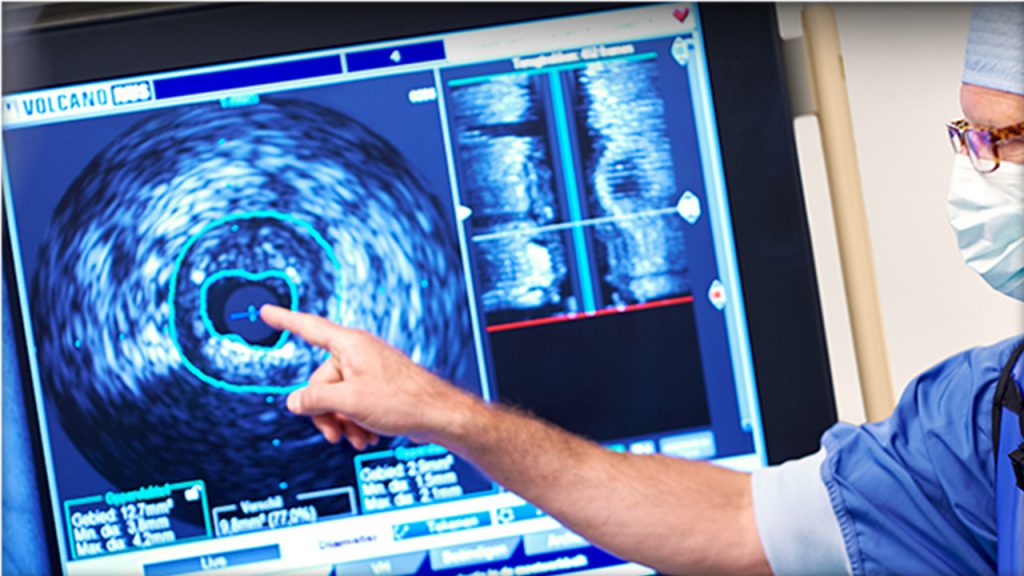 Doctor using IVUS monitor